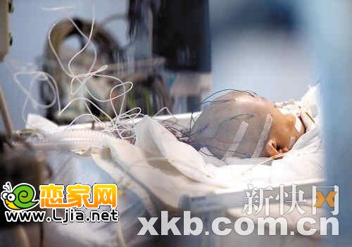 昨日，據(jù)醫(yī)生介紹，小悅悅的情況出現(xiàn)惡化