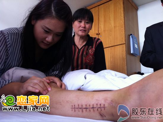 一條腿換來一條命，值