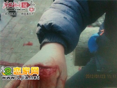 受害者 