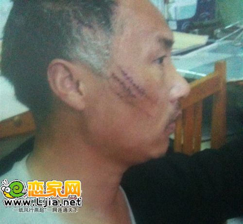 受害者 